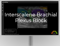 Homepage - Nerveblox - Ultrasound Intelligence